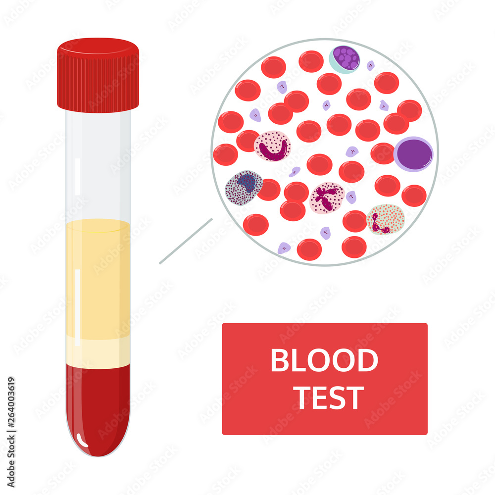 Medical vector concept blood analysis in test tubes and a drop of