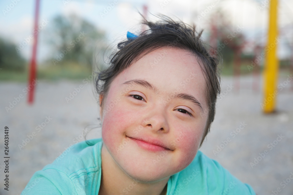 Portrait of down syndrome girl smiling Portrait of down syndrome girl smiling