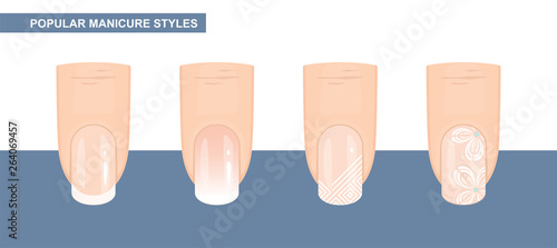 Most Popular Nail Designs. Manicure styles. Vector Illustration