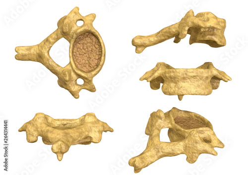 morphology of the cervical vertebra, sixth cervical vertebra, multiple angles and views photo