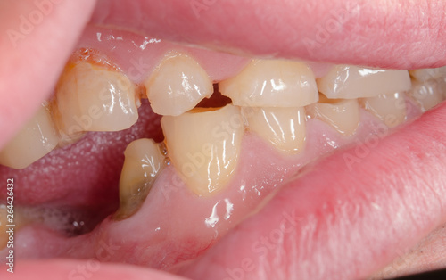 closeup of teeth