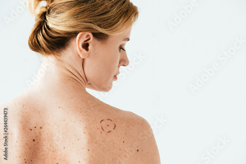 attractive woman with marks on back isolated on white