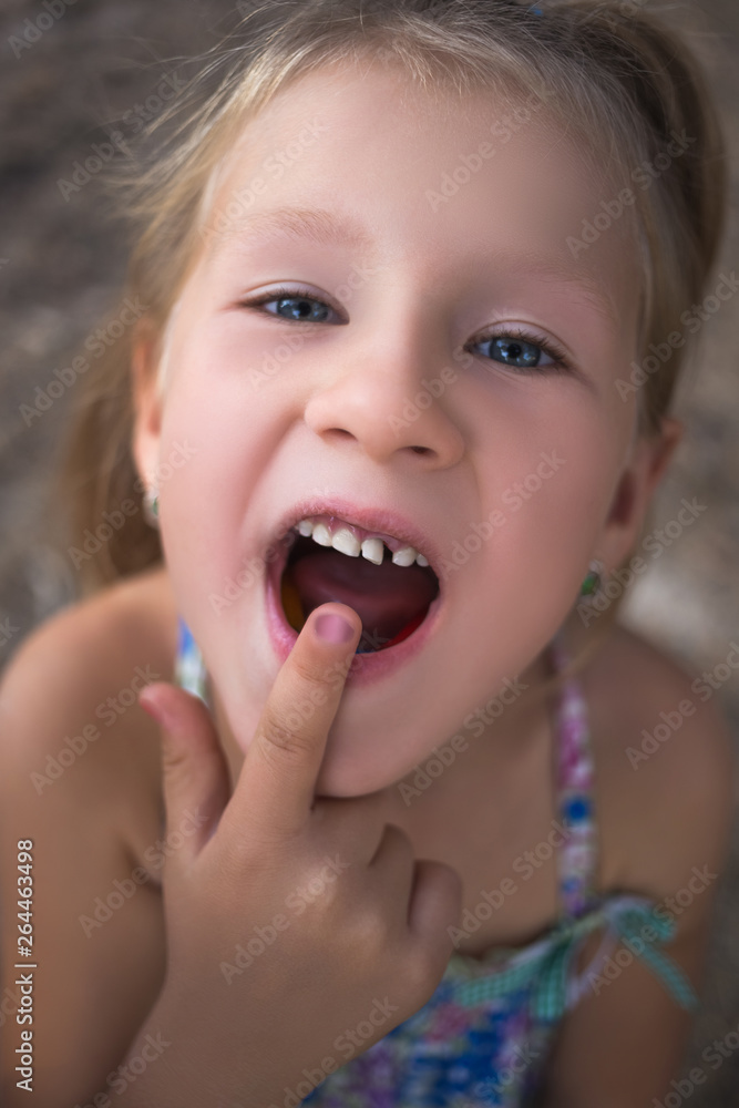 Little girl points the finger at a wobbly baby tooth Little girl points the finger at a wobbly baby tooth