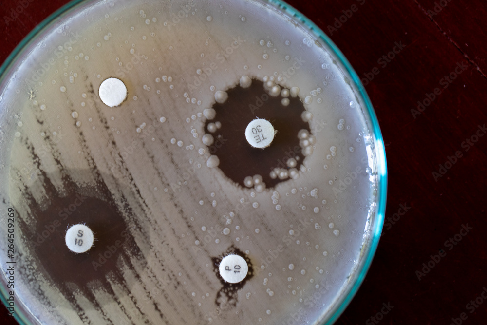 Drug testing of microbiology laboratory. Drug testing of microbiology laboratory.