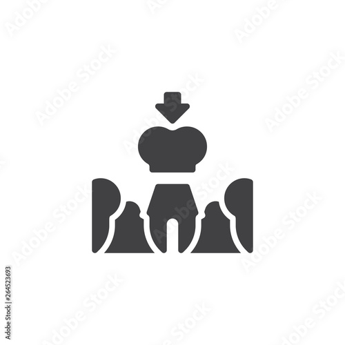 Tooth implant installation vector icon. Ceramic dentures and crown filled flat sign for mobile concept and web design. Tooth restoration glyph icon. Symbol, logo illustration. Pixel perfect vector 