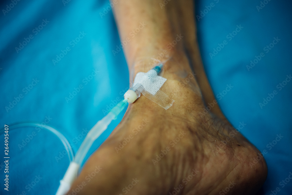 Patient with saline intravenous in the hospital