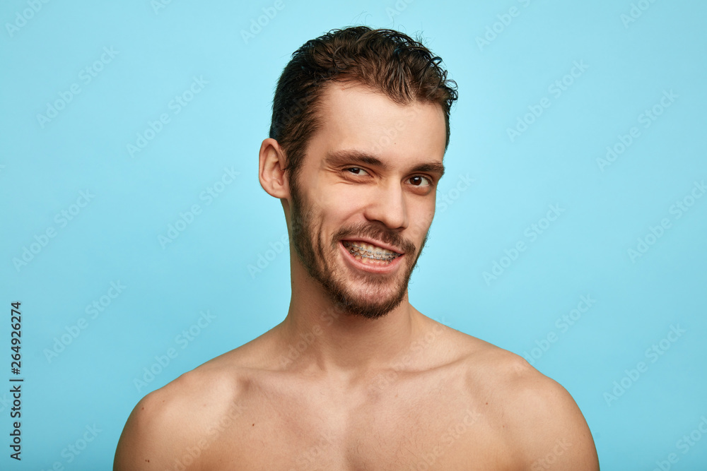 smiling man showing his teeth, dental braces to the camera, teeth care, health care,alighing and straightening teeth, improvement of dental health smiling man showing his teeth, dental braces to the camera, teeth care, health care,alighing and straightening teeth, improvement of dental health