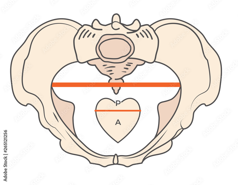 Android Pelvis Shape w Triangular / Heart shape Android Pelvis Shape w Triangular / Heart shape