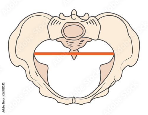 Android Pelvis Shape w Triangular / Heart shape