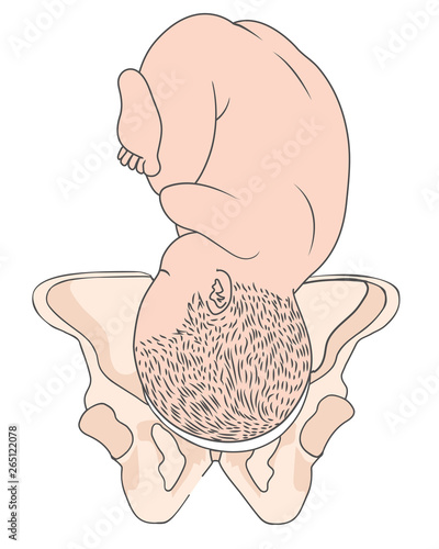 Left Occiput Anterior LOA Baby Fetal Position  ROA Right photo