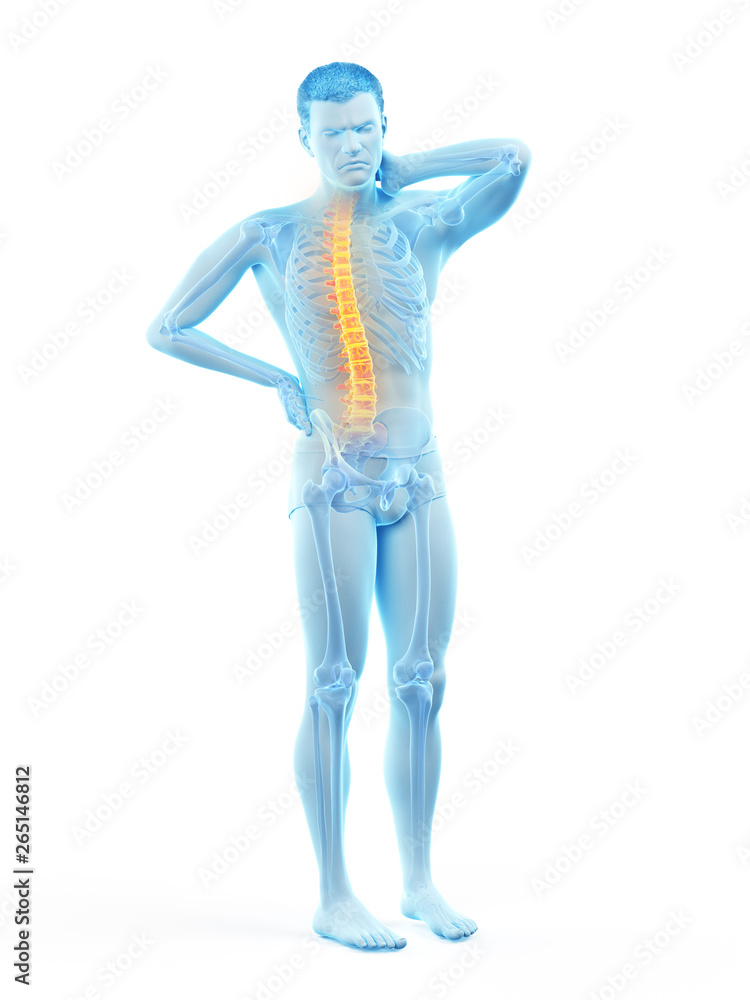 3d rendered medically accurate illustration of a man having a backache