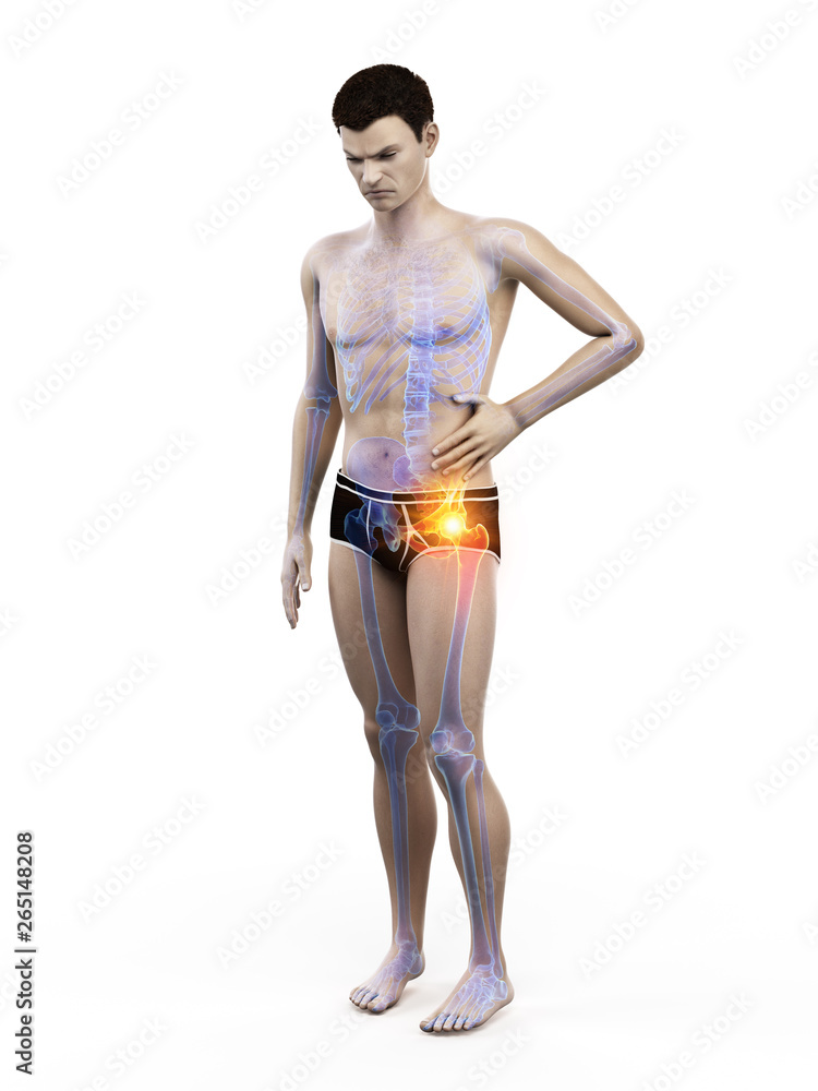 3d rendered medically accurate illustration of a man having a painful hip joint