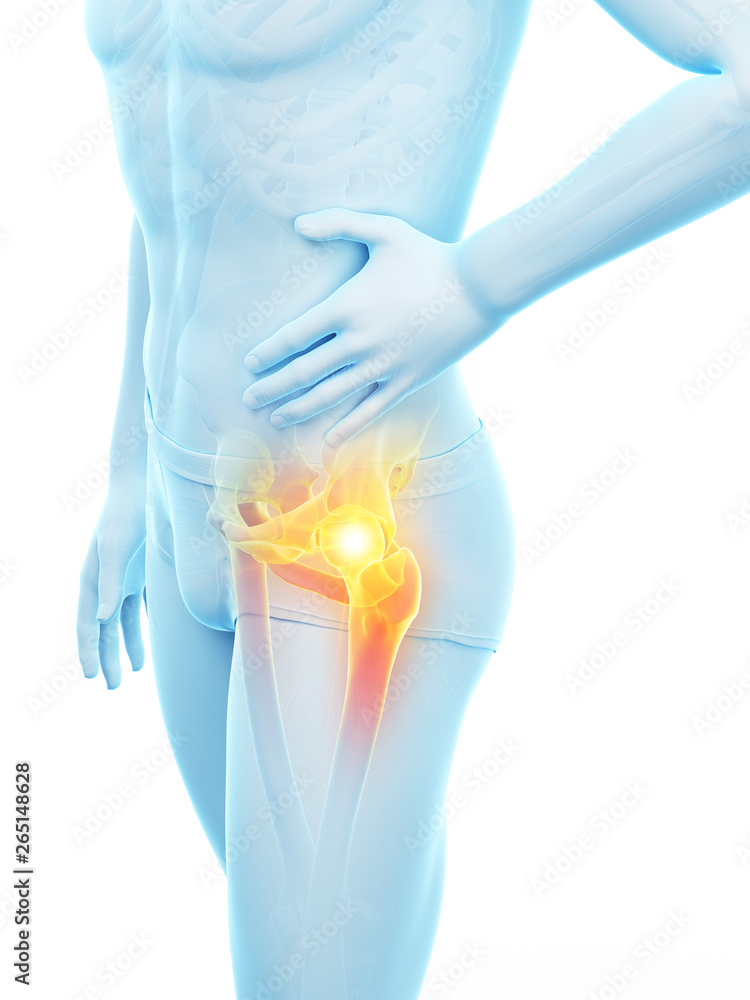 3d rendered medically accurate illustration of a man having a painful hip joint 3d rendered medically accurate illustration of a man having a painful hip joint