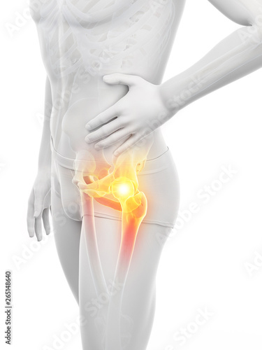 3d rendered medically accurate illustration of a man having a painful hip joint