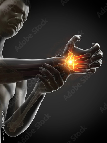 Fotografi 3d rendered medically accurate illustration of a man having a painful wrist