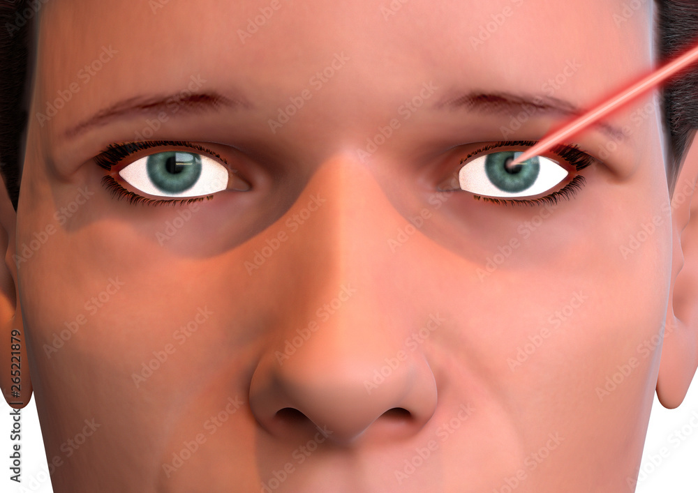 Obraz premium Correction of the vision of the human eye by a laser beam. Modern treatment of ophthalmology