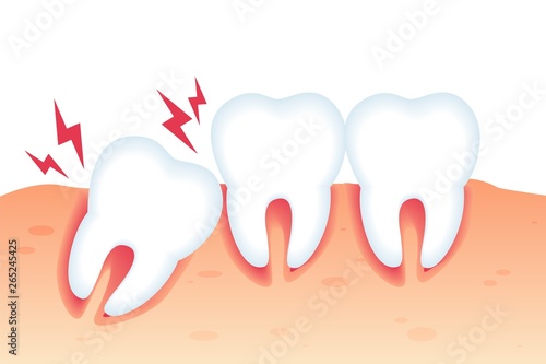 Vector Illustration Pain from Wrong Bite Flat.