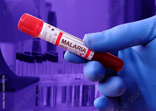 Infected with malaria virus laboratory flask with blood samples. photo
