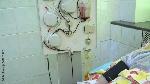 Plasmapheresis. Cleaning the patient's blood through the device. The process of removing blood plasma from the circulation. Apparatus close-up. Male hand close up. photo