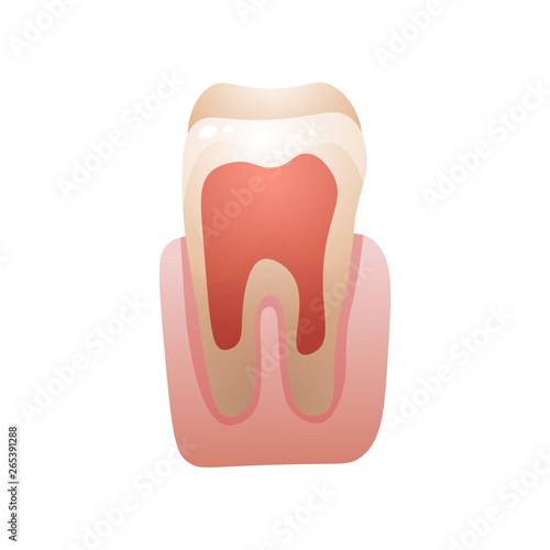 Ill red tooth, waiting for medical stomatology investigation