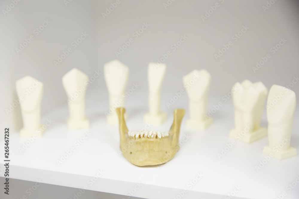 dental implants. ceramic models of teeth. jaw dental implants. ceramic models of teeth. jaw