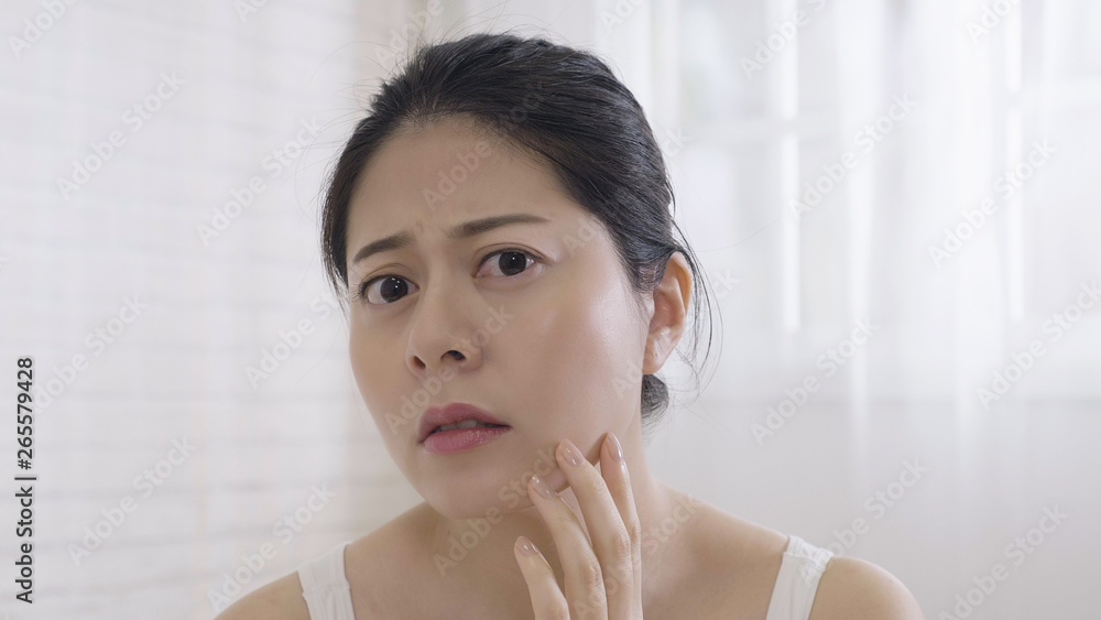 Portrait of unhappy asian lady found pimple on cheek while touching with hand. female looking camera as mirror with white background sunshine window and curtain. frowning sad woman feeling face skin Portrait of unhappy asian lady found pimple on cheek while touching with hand. female looking camera as mirror with white background sunshine window and curtain. frowning sad woman feeling face skin