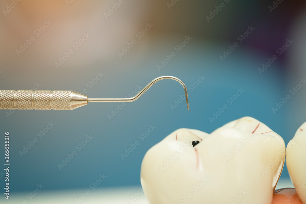 Clos up dental equipment,hook and dental model Clos up dental equipment,hook and dental model