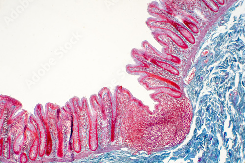 Human large intestine tissue under microscope view. photo