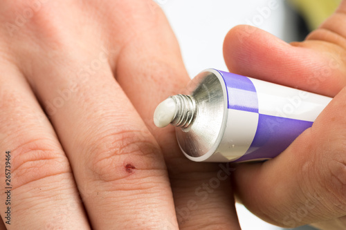 ointment for external use a little squeezed out of a tube on a white background, near the cover