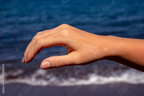 Female hand with red sunburn skin on blue sea background. Sun burned skin peeling. Seaside threat. © Elya.Q