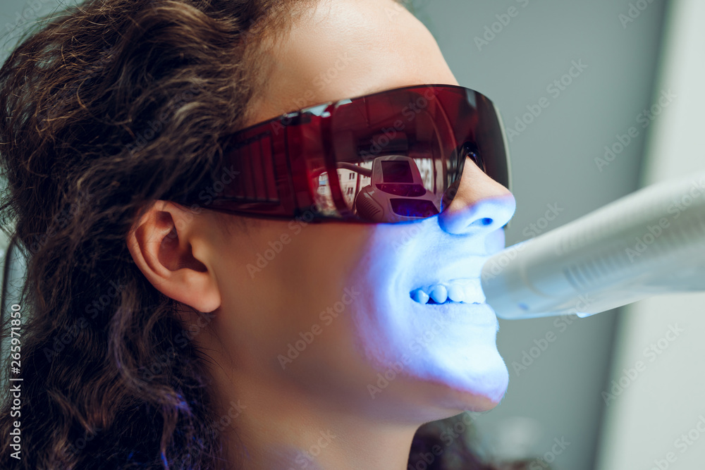 Girl patient in the dental clinic. Teeth whitening UV lamp with