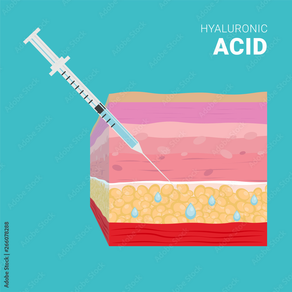 Hyaluronic acid injection, thin syringe vector illustration. Skin