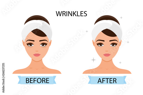 Girl has wrinkles on her face. Before and after. Concept of skincare, pure and healthy skin. Vector illustration.