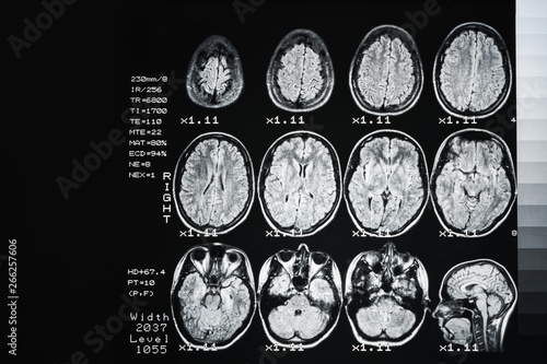 The result is an MRI of the brain with values and numbers. Medical background