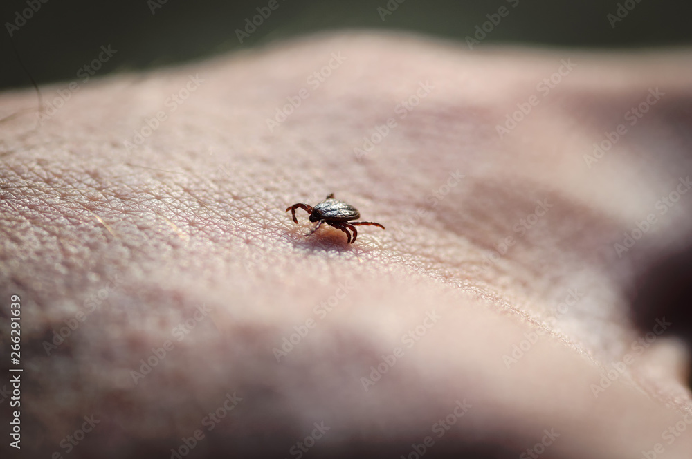Tick insect parasite crawling on human skin. Hard tick (Ixodes) Tick insect parasite crawling on human skin. Hard tick (Ixodes)