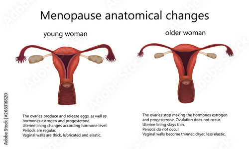 Menopause anatomical changes. Comparison of female reproductive system of young woman and older woman with explanations. Realistic anatomy vector illustration. photo