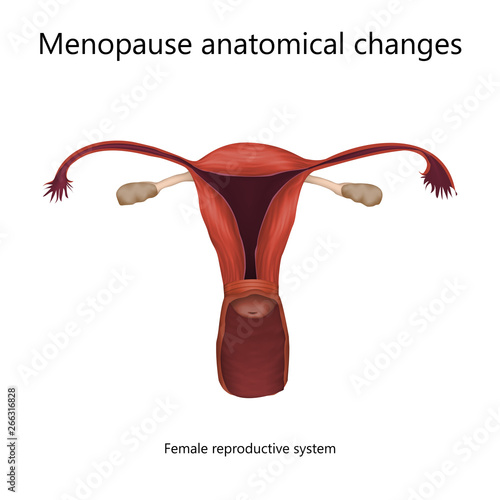 Menopause anatomical changes. Female reproductive system of older woman. Realistic anatomy vector illustration.