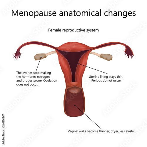 Menopause anatomical changes. Female reproductive system of older woman with explanations. Realistic anatomy vector illustration.