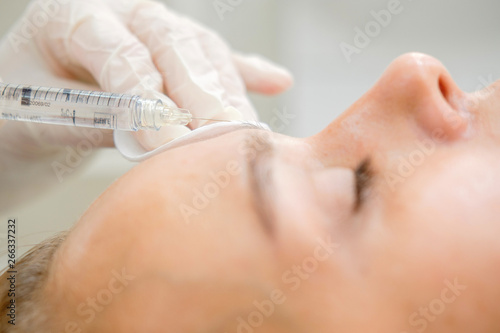 Cosmetologist making mesotherapy. Syringe and needle  facial cosmetic beauty injection. Woman patient is getting face rejuvenation procedure at beautician. Hardware cosmetology  Hyaluronic Acid