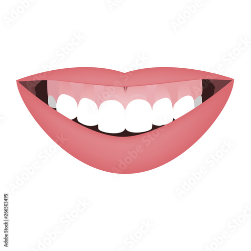 Mouth with a distal bite and high smile line or gummy smile before the orthotropics or orthotropics treatment. Vector illustration