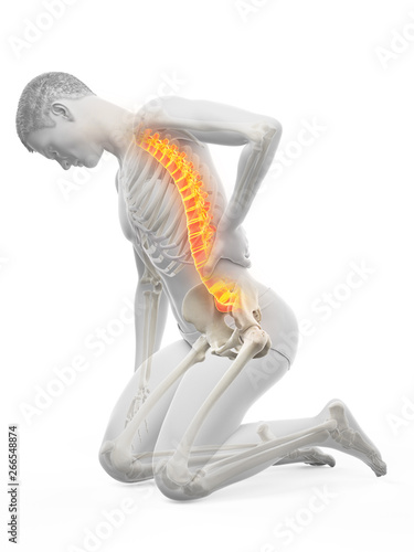 3d rendered medically accurate illustration of a man having acute back pain