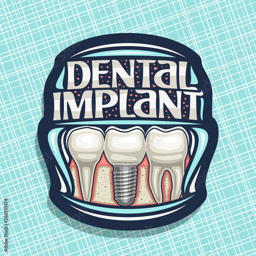 Vector logo for Dental Implant, dark decorative label with 3 cartoon human teeth in jaw, original lettering for words dental implant, sign board for professional denture clinic on blue background.