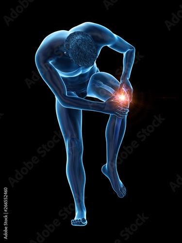 3d rendered medically accurate illustration of a man having a painful knee