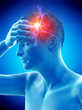 3d rendered medically accurate illustration of a man having a migraine