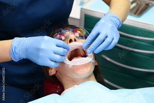 The doctor puts a silicone dilator in the mouth for comfortable dental treatment to the patient. Concept of dental treatment and beauty.Macro photo.