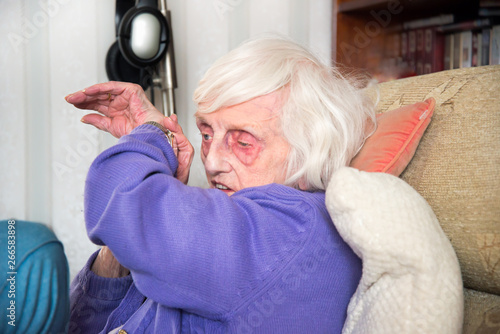 Visually impaired old woman listening to speaking watch.