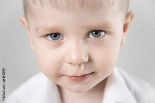 child has a runny nose with clear snot photo