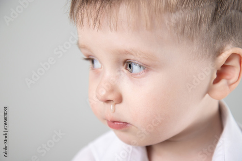 Photos child has a runny nose with clear snot
