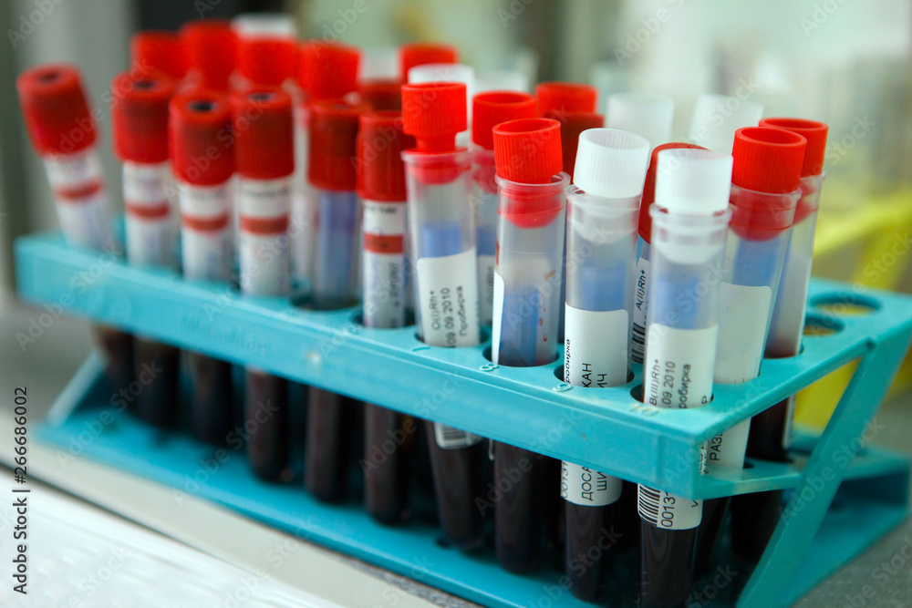 Blood tubes in the lab. Tests, donation. Blood tubes in the lab. Tests, donation.