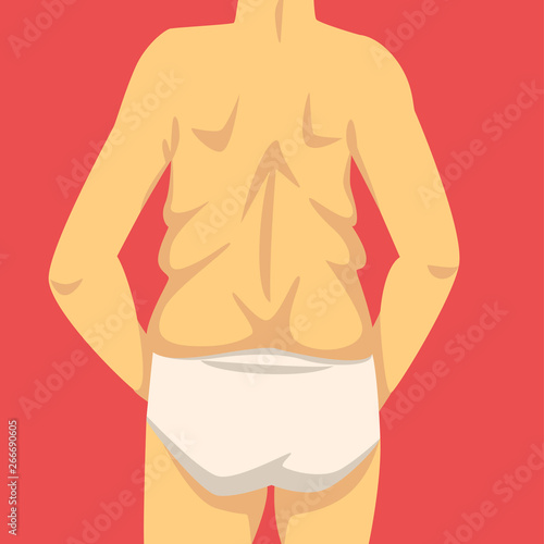 Male Torso, Human Body After Weight Loss, Back View, Obesity and Unhealthy Eating Problems Vector Illustration
